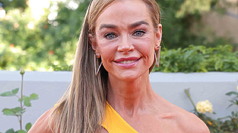 „Не е нещо, което бих могла да скрия“: Дениз Ричардс с шокиращи кадри преди и след пластичната си операция 